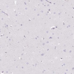 D-Glutamate Cyclase Antibody, Novus Biologicals 0.1mL; Unlabeled:Antibodies,